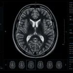 Realistická ilustračná MRI snímka ľudského mozgu v medicínskom zobrazovacom štýle na tmavom pozadí.